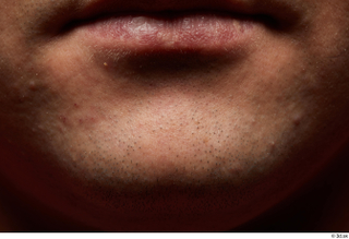 HD Face Skin Raymon Kastor chin face lips mouth skin…